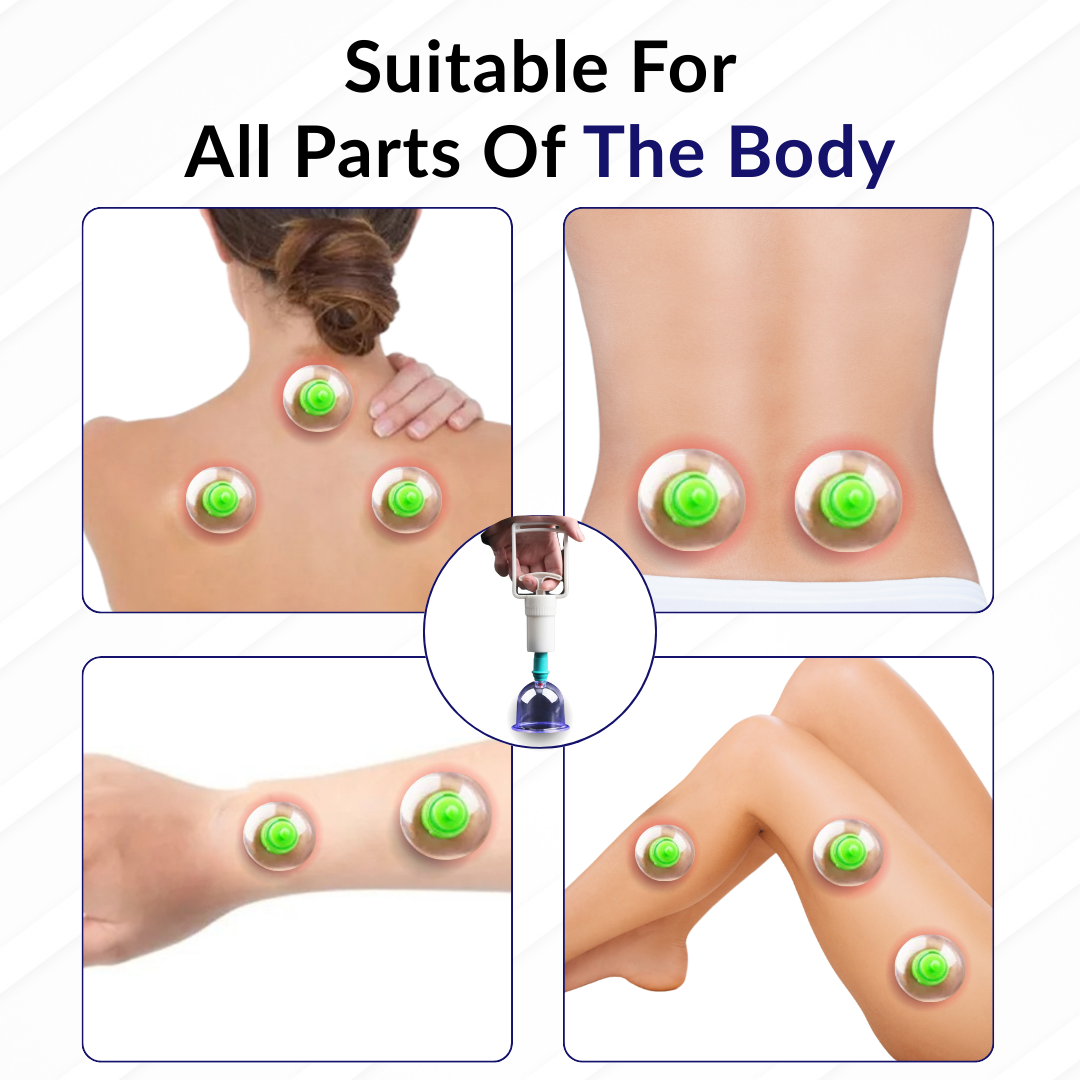 Cupping Therapy Set(6 PCS) – Vacuum Suction for Detox & Anti-Cellulite