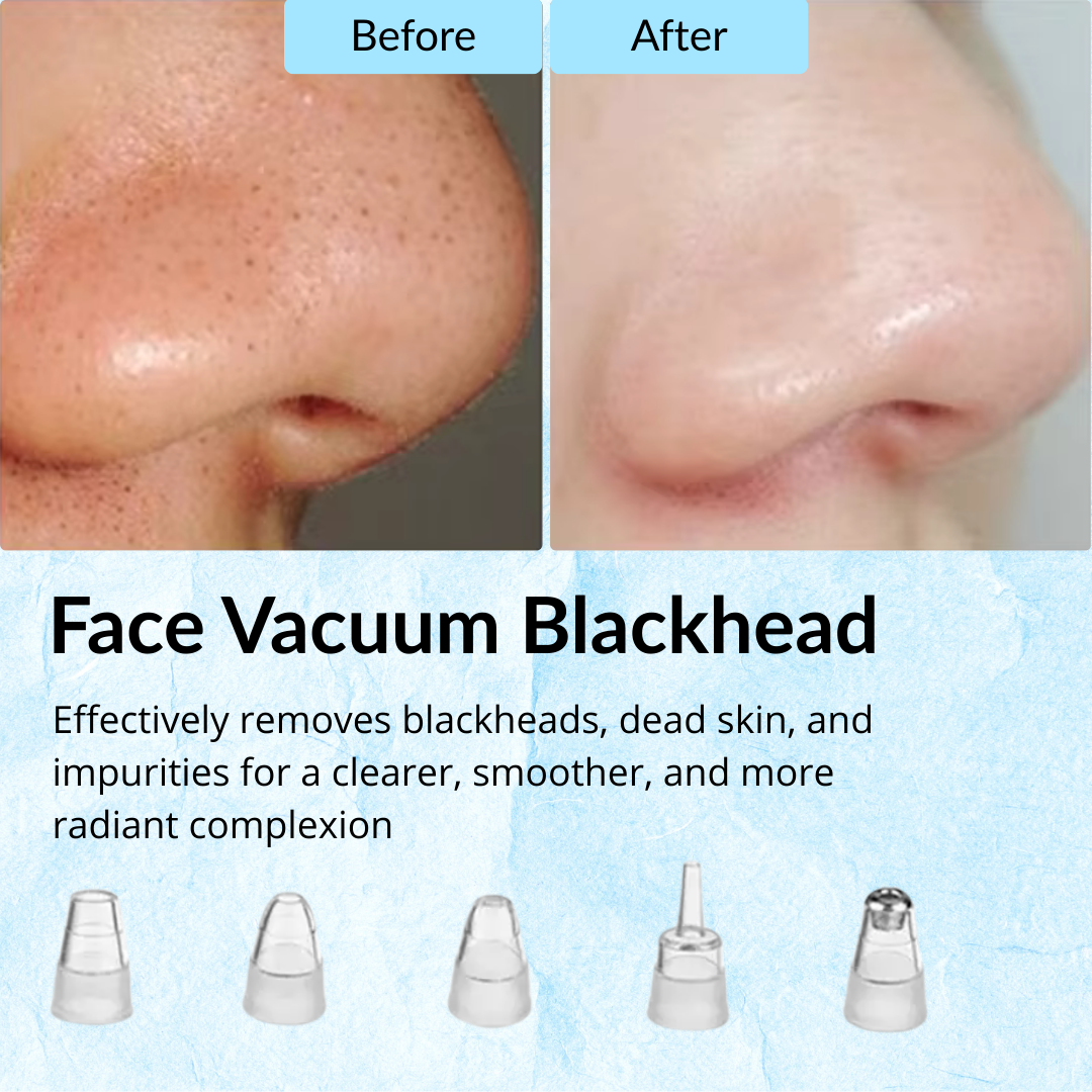 Blackhead Remover Pore Vacuum -Exfoliating Face Cleanser