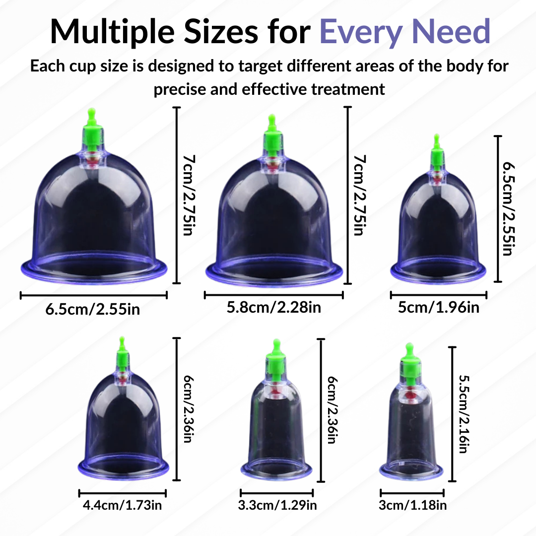 Cupping Therapy Set(6 PCS) – Vacuum Suction for Detox & Anti-Cellulite