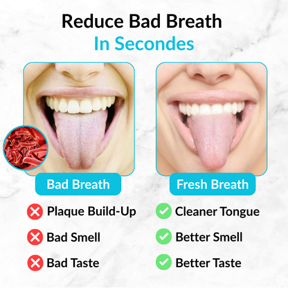 Premium Metal Tongue Scraper – Stainless Steel Cleaner